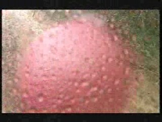 I'm a Celebrity - Hell Hill 2